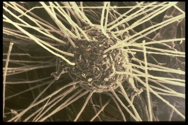 mycorrhizal-filaments